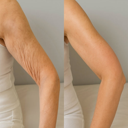 Same bathroom mirror, ten weeks apart — left, deflated and crepey skin after rapid GLP-1 weight loss; right, visibly recovered skin texture after the three-part protocol