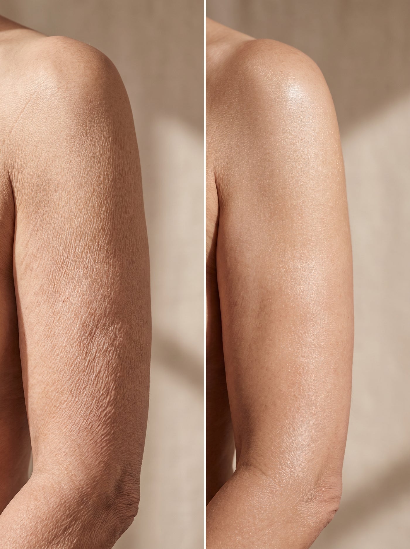 Crepey Arms That Appear in One Season Are Not “Just Aging” — I Flew to Paris to Debunk the Woman Saying So. Then I Read Her Files.