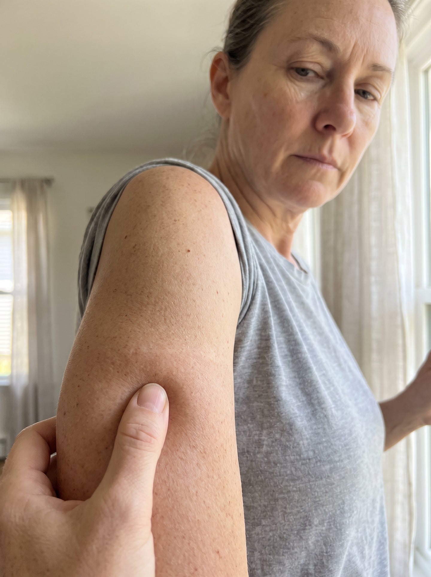Your Crepey Arms Didn't Age. They Collapsed — And There's a Word for It.