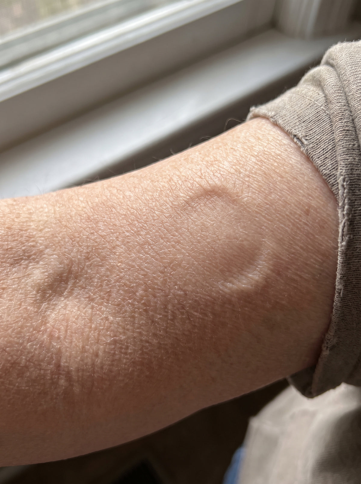 The pinch told her more than any scan — and it took four seconds