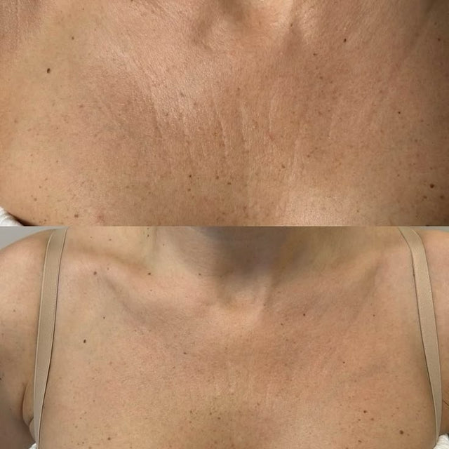 B/A split · décolleté · 640×400