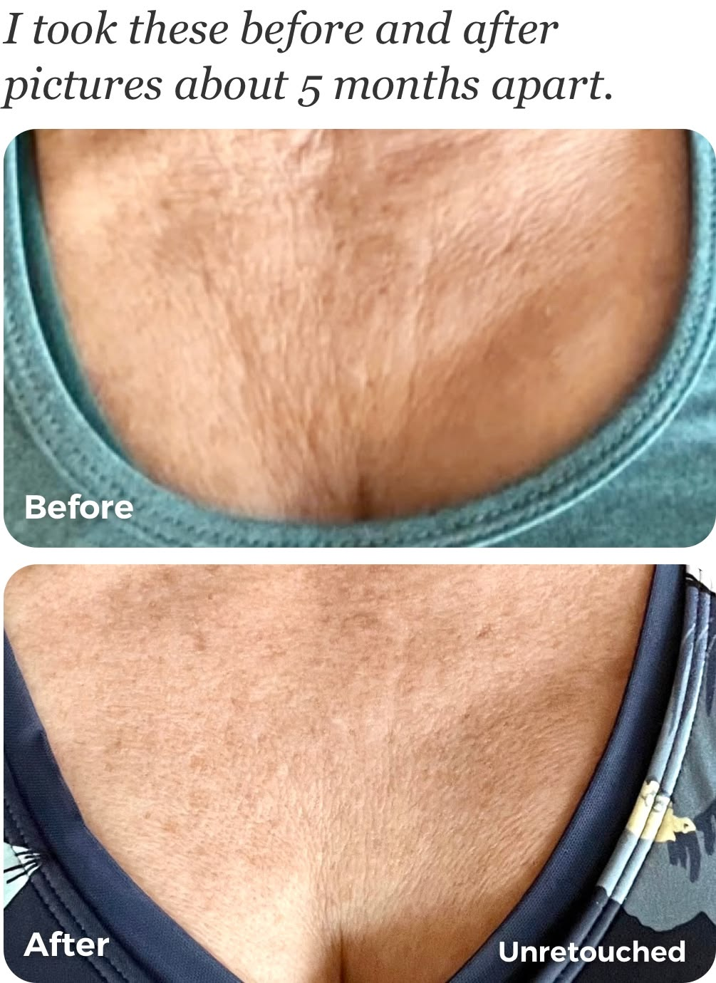 Woman in her 50s at her bathroom mirror in morning light, looking down at the crepey skin across her chest above a V-neck
