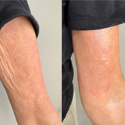 Eraé - Queen Oil 120mL