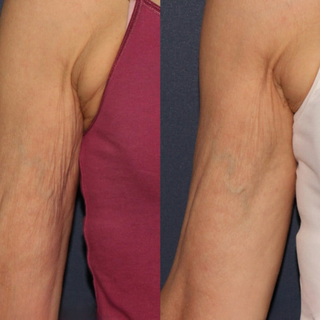 Fixing (7).png__PID:3ec6000d-9495-4e4c-b6f9-764794eaa324