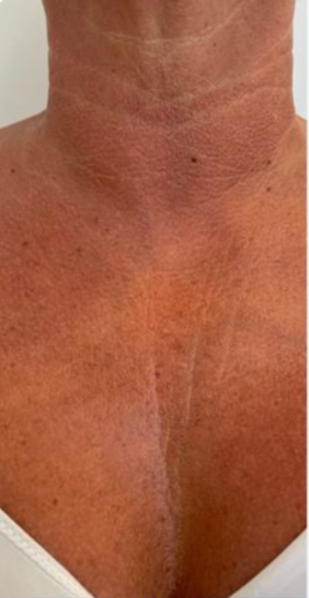 Linda, 64