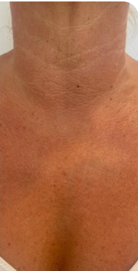 Linda, 64