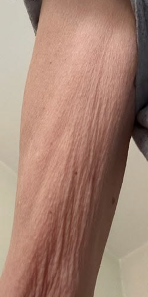 DAY 0