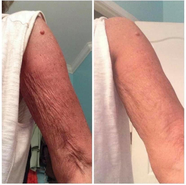 B/A split · upper arms · 640×400