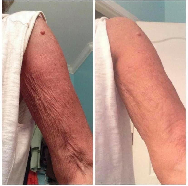 Denise, 58
