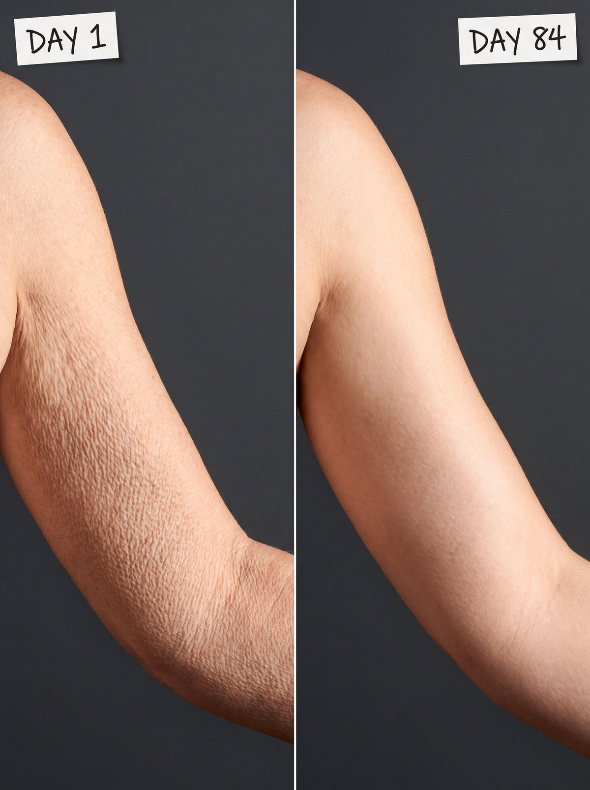 Crepey Arms That Arrive in One Season Aren't 'Just Aging' — So We Put 23 Women and a Paris Method to a 12-Week Test