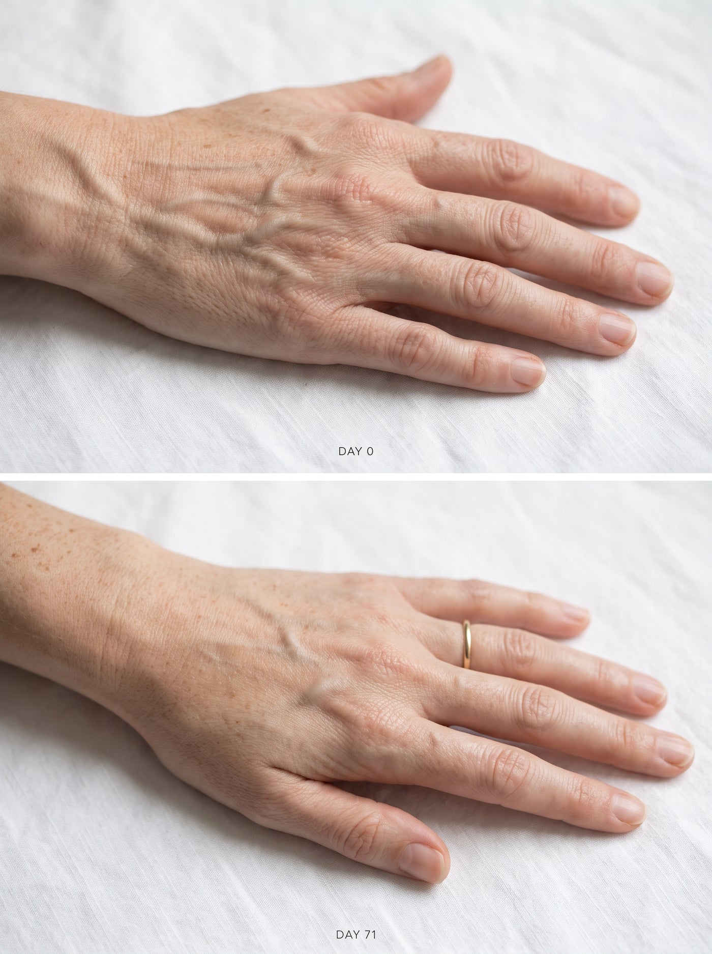 Crepey Hands Aren’t “Just What Hands Do.” I Spent 22 Years Saying They Were.