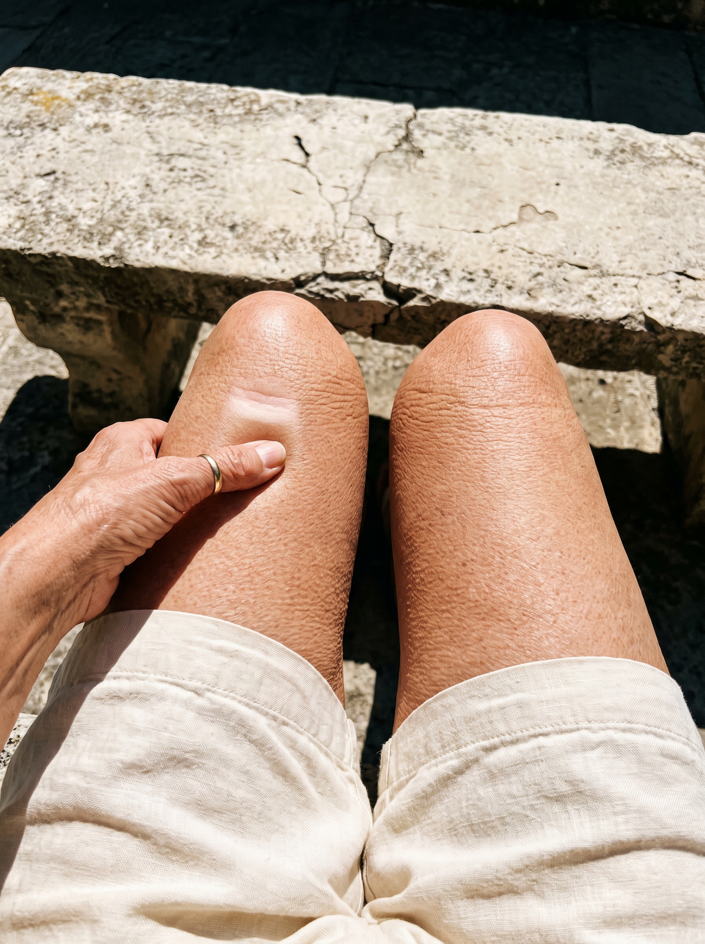 Your Knees Didn't Age — They Collapsed: 7 Things the Cream Aisle Never Told You About Crepey Knees