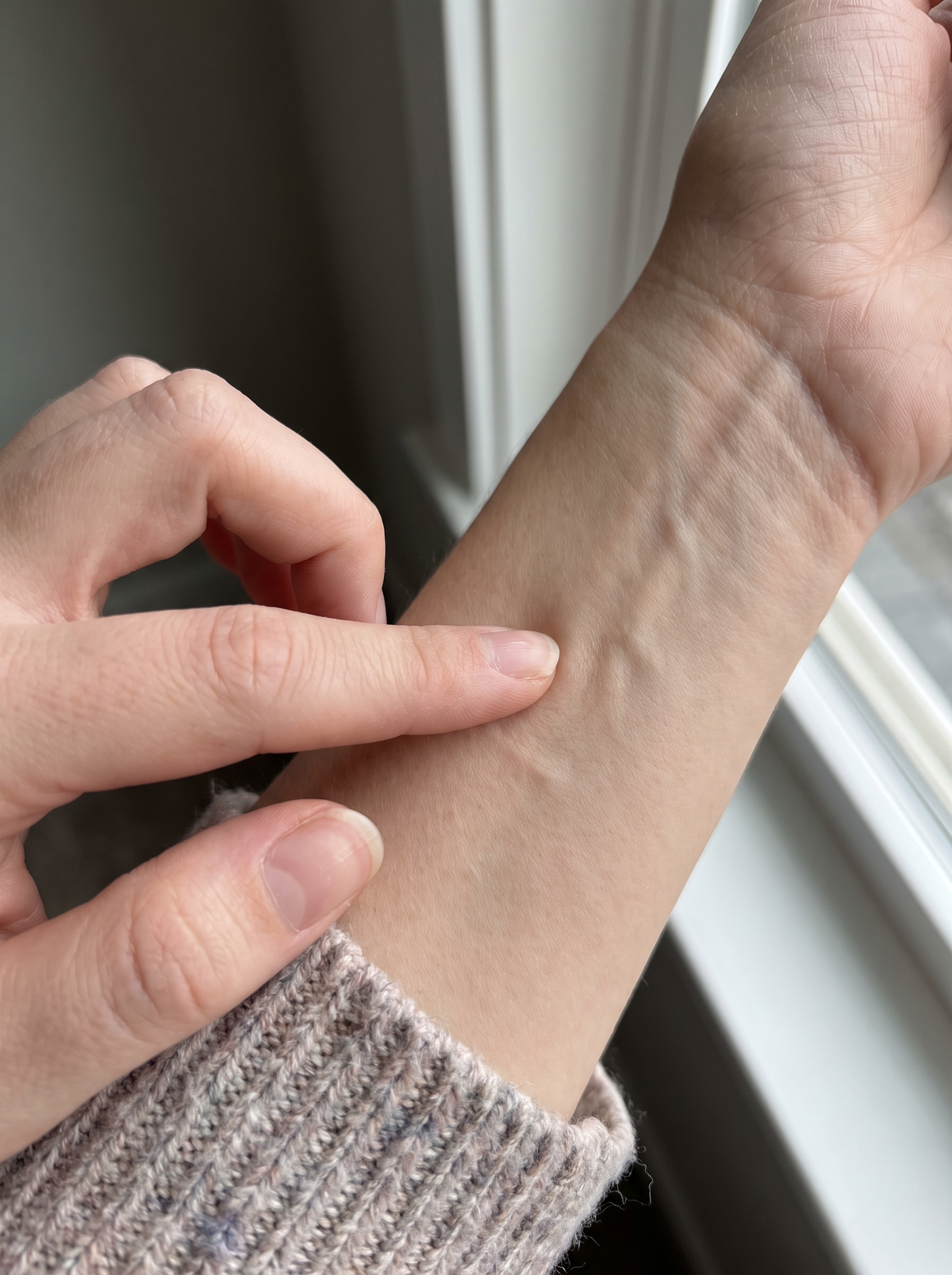 6. Testing Your Skin's Recovery Power In Seconds At Home