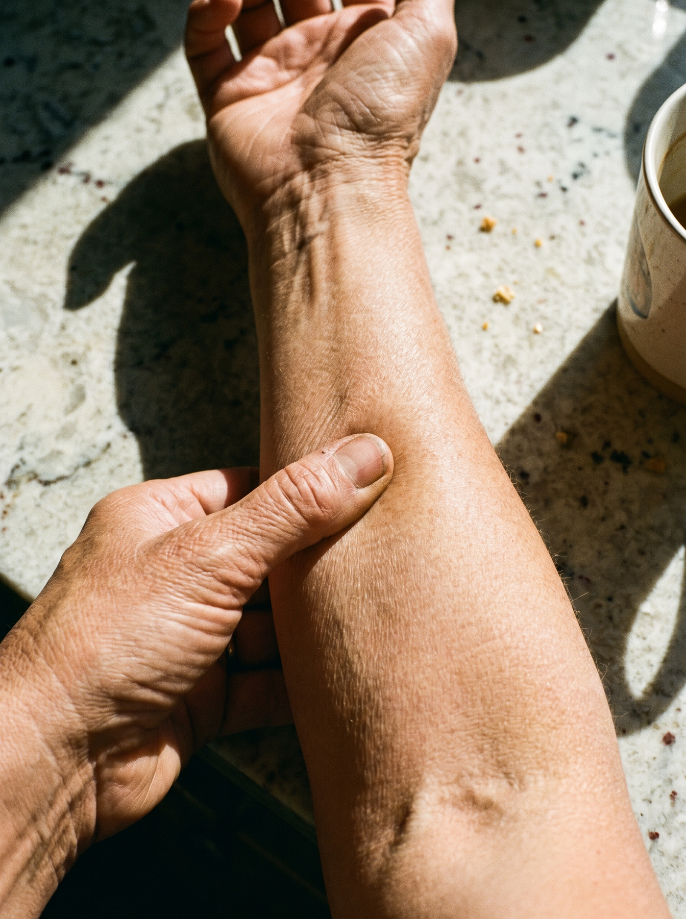 The pinch test: an indent that lingers four seconds or more points to structural collapse — and to skin that is dormant, not dead.