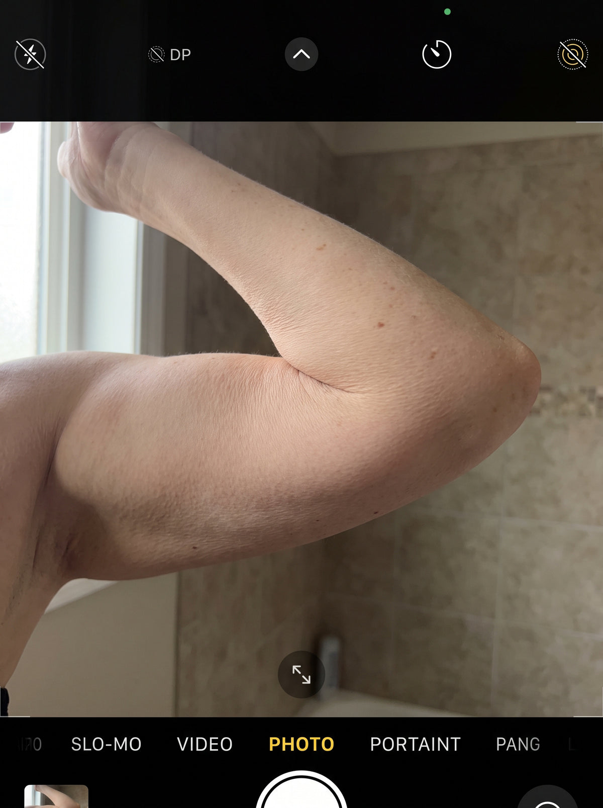 The support layer under your arm skin is not dying — it went dormant, and dormant can be woken