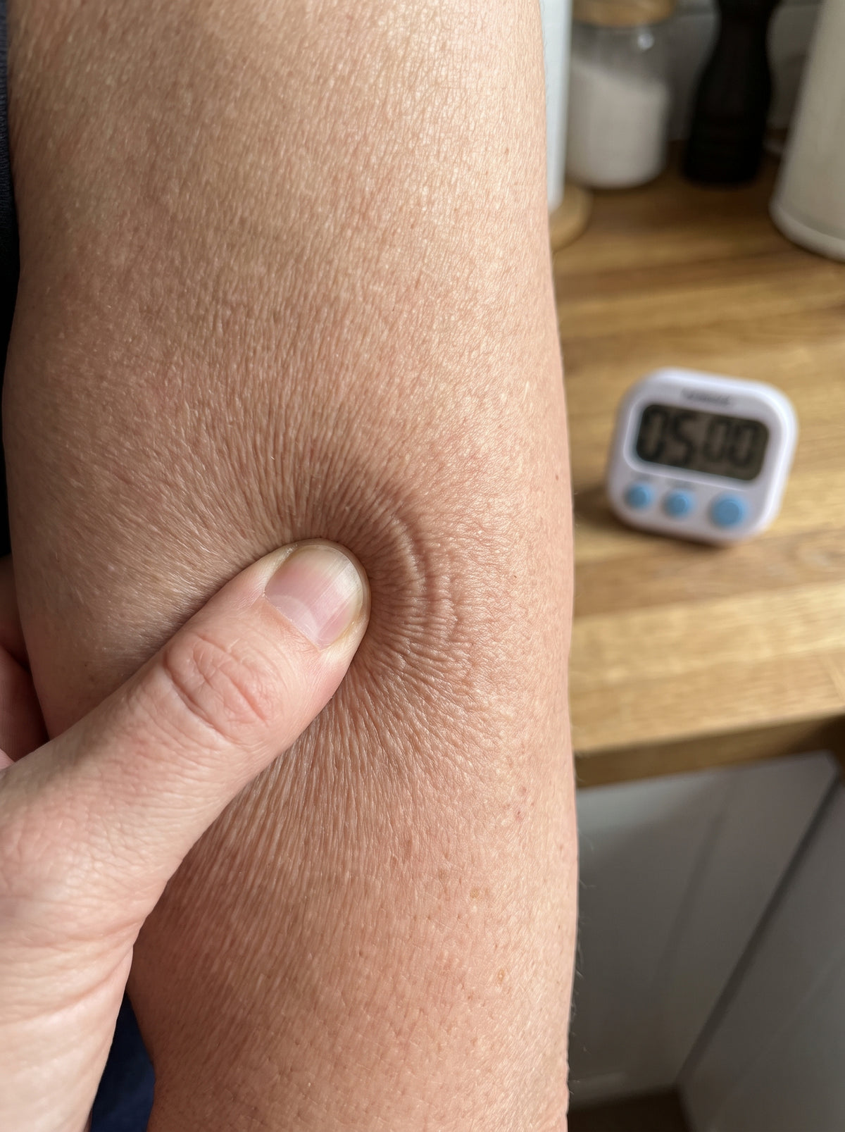 6. The pinch test — a home measurement you can run before you spend a cent
