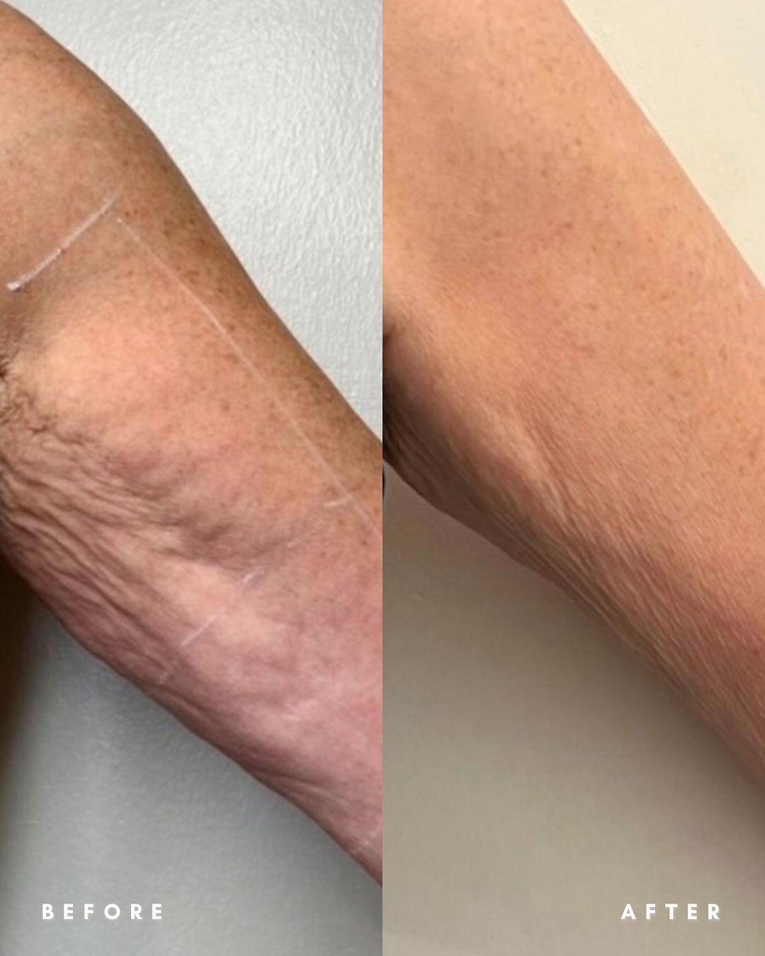 Eraé - Queen Oil 120mL