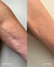 Eraé - Queen Oil 120mL