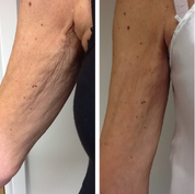 Eraé - Queen Oil 120mL