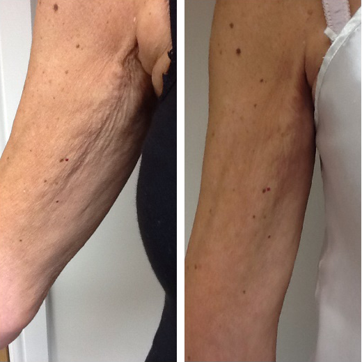 Eraé - Queen Oil 120mL