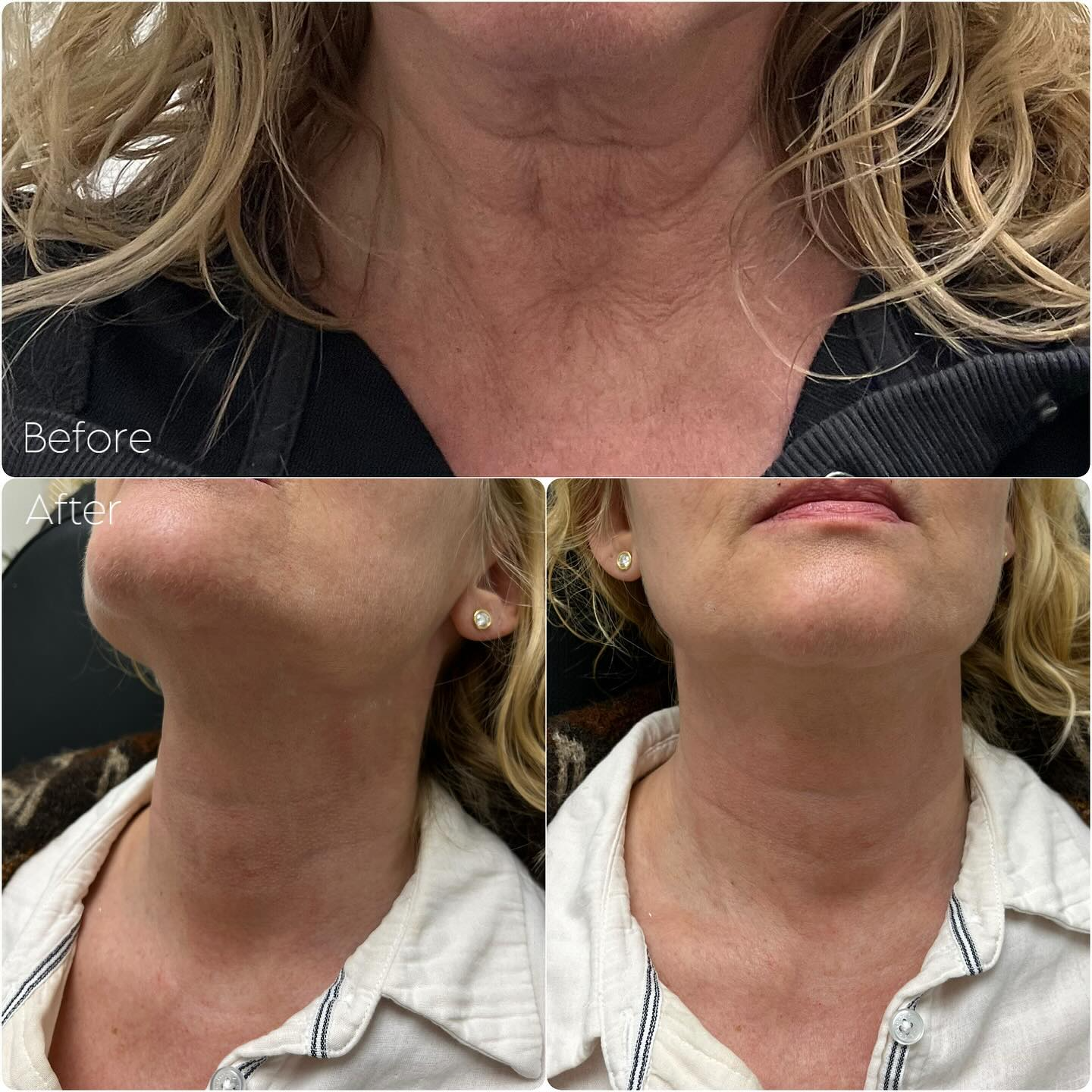 Eraé - Queen Oil 120mL