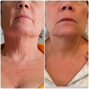 Eraé - Queen Oil 120mL