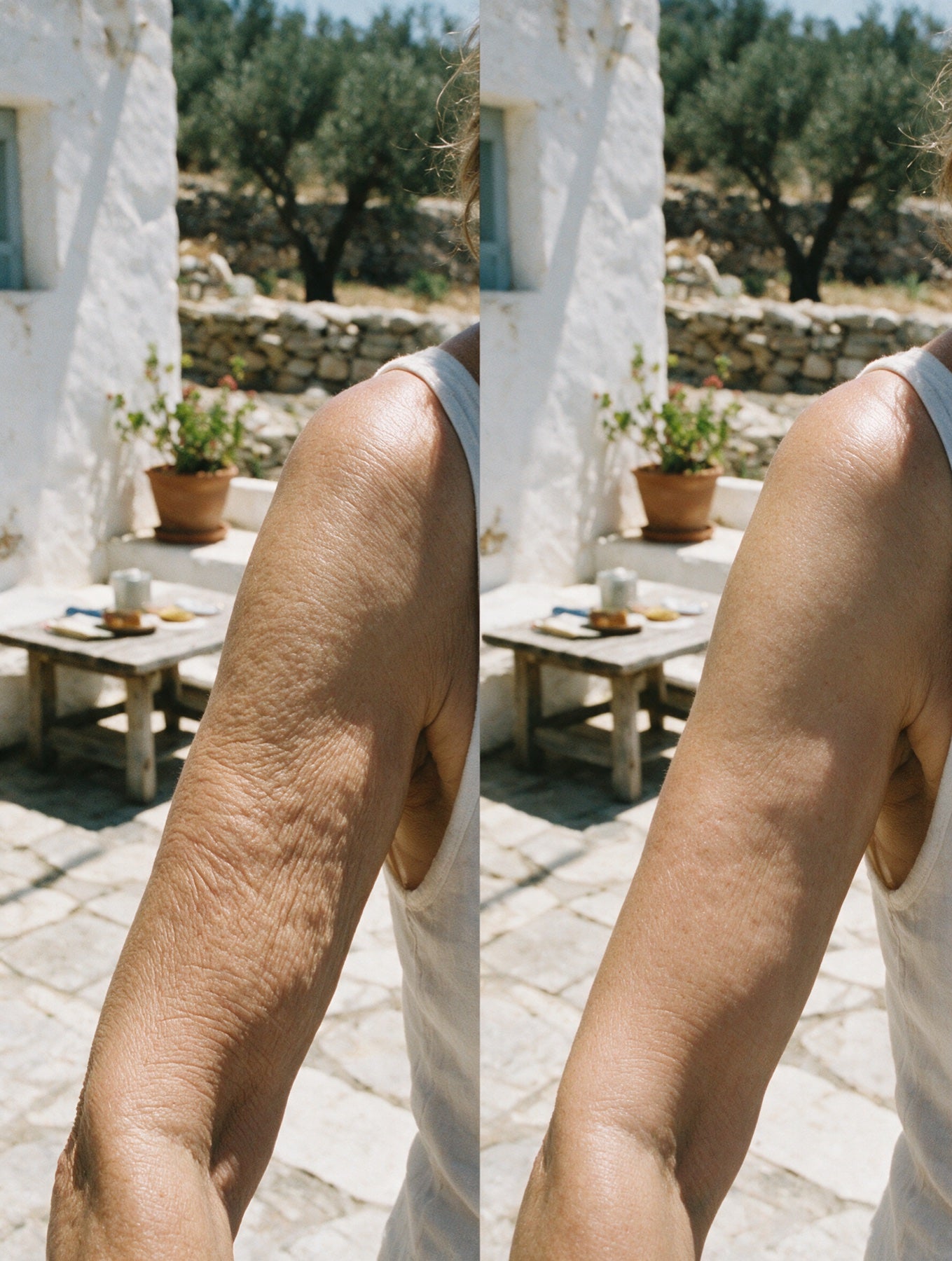 Smooths Crepey Upper Arms in Weeks